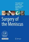 Surgery of the Meniscus cover