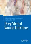 Deep Sternal Wound Infections cover