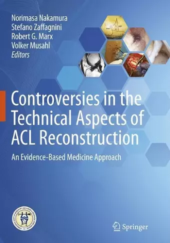 Controversies in the Technical Aspects of ACL Reconstruction cover