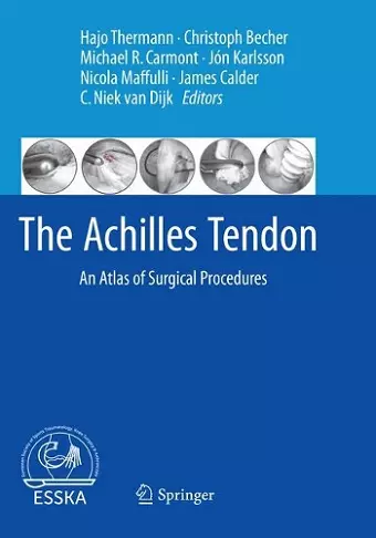 The Achilles Tendon cover