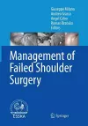 Management of Failed Shoulder Surgery cover