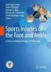 Sports Injuries of the Foot and Ankle cover