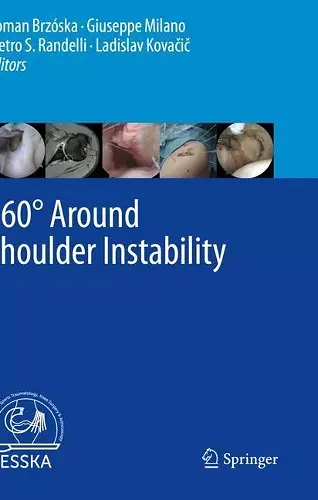 360° Around Shoulder Instability cover