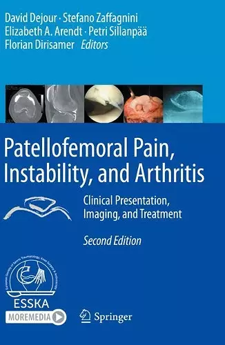 Patellofemoral Pain, Instability, and Arthritis cover