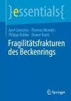 Fragilitätsfrakturen des Beckenrings cover
