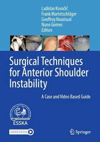 Surgical Techniques for Anterior Shoulder Instability cover
