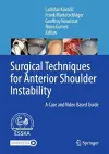 Surgical Techniques for Anterior Shoulder Instability cover