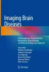 Imaging Brain Diseases cover