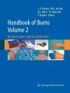 Handbook of Burns Volume 2 cover