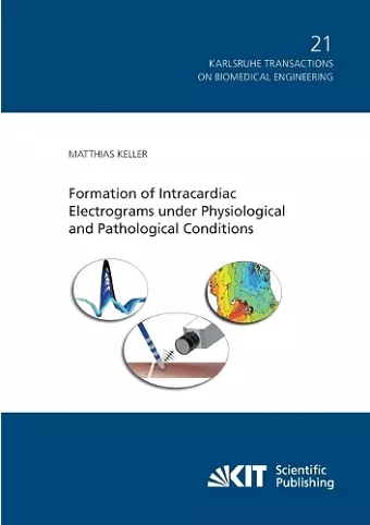 Formation of Intracardiac Electrograms under Physiological and Pathological Conditions cover