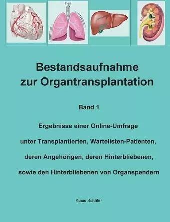 Bestandsaufnahme zur Organtransplantation cover