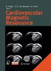 Cardiovascular Magnetic Resonance cover