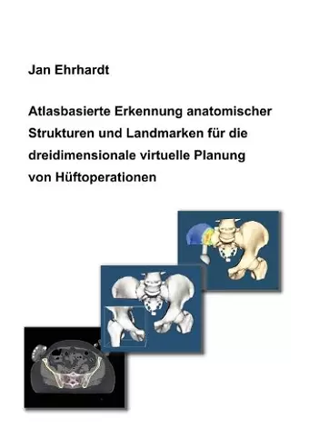 Atlasbasierte Erkennung anatomischer Strukturen und Landmarken für die dreidimensionale virtuelle Planung von Hüftoperationen cover