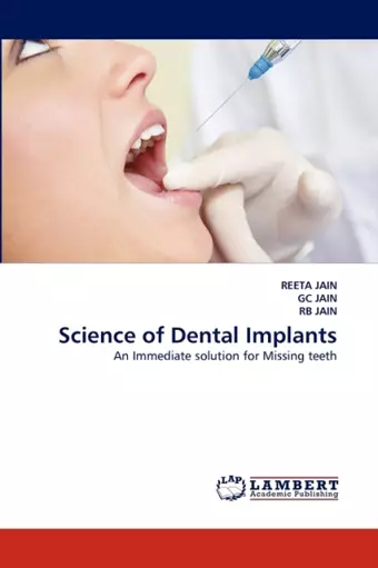 Science of Dental Implants cover