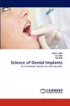 Science of Dental Implants cover