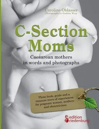 C-Section Moms - Caesarean mothers in words and photographs cover