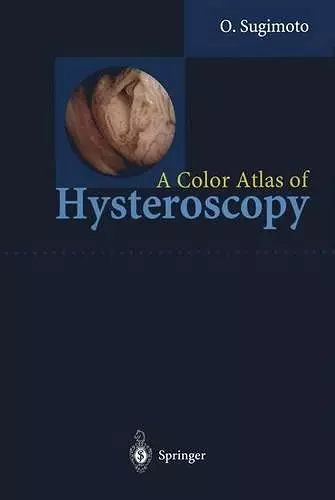 A Color Atlas of Hysteroscopy cover