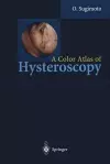 A Color Atlas of Hysteroscopy cover