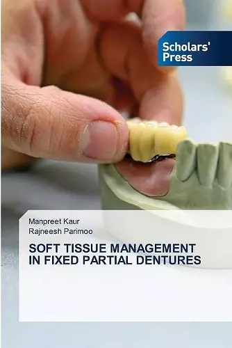 Soft Tissue Management in Fixed Partial Dentures cover