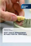 Soft Tissue Management in Fixed Partial Dentures cover