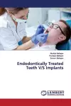 Endodontically Treated Teeth V/S Implants cover