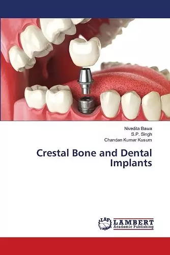 Crestal Bone and Dental Implants cover