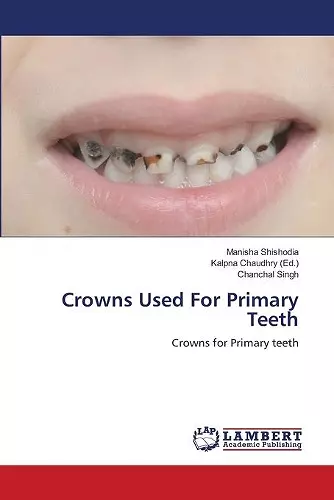 Crowns Used For Primary Teeth cover