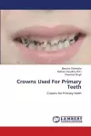 Crowns Used For Primary Teeth cover