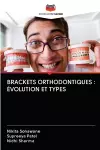 Brackets Orthodontiques cover