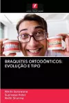 Braquetes Ortodônticos cover