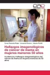 Hallazgos imagenológicos de cáncer de mama en mujeres menores 50 años cover