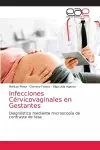 Infecciones Cérvicovaginales en Gestantes cover