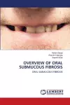 Overview of Oral Submucous Fibrosis cover