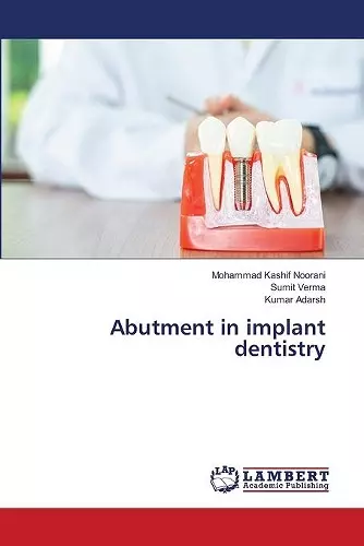 Abutment in implant dentistry cover