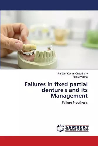 Failures in fixed partial denture's and its Management cover