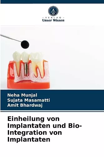 Einheilung von Implantaten und Bio- Integration von Implantaten cover