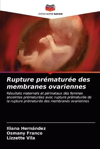 Rupture prématurée des membranes ovariennes cover