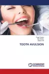 Tooth Avulsion cover