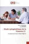 Etude cytogénétique de la Trisomie 21 cover