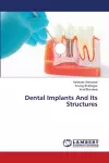 Dental Implants And Its Structures cover