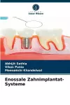 Enossale Zahnimplantat-Systeme cover