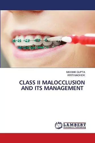 Class II Malocclusion and Its Management cover