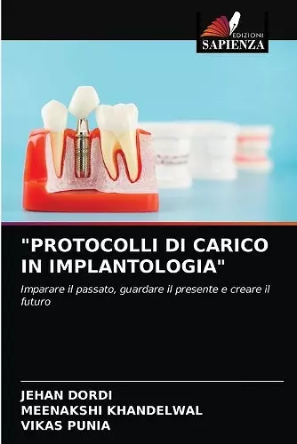 Protocolli Di Carico in Implantologia cover