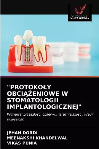 Protokoly ObciĄŻeniowe W Stomatologii Implantologicznej cover