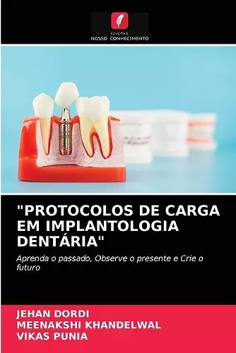 Protocolos de Carga Em Implantologia Dentária cover