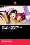 Lesões Dentárias Traumáticas cover