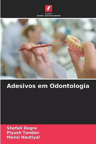 Adesivos em Odontologia cover