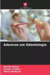 Adesivos em Odontologia cover