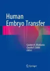 Human Embryo Transfer cover