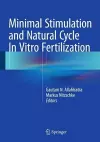 Minimal Stimulation and Natural Cycle In Vitro Fertilization cover
